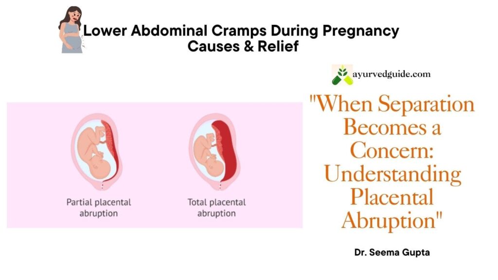 Placental Abruption