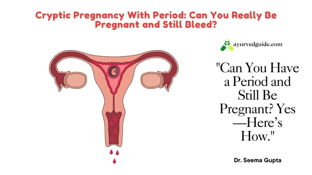 Can You Have a Period With a Cryptic Pregnancy